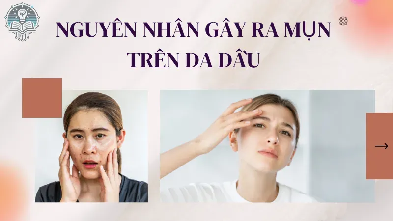 chăm sóc da dầu mụn 1