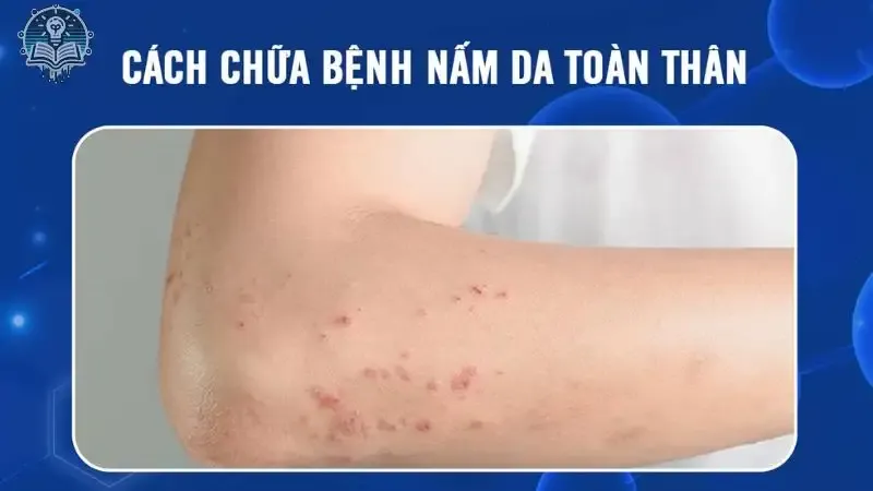 tác hại do nấm da 2