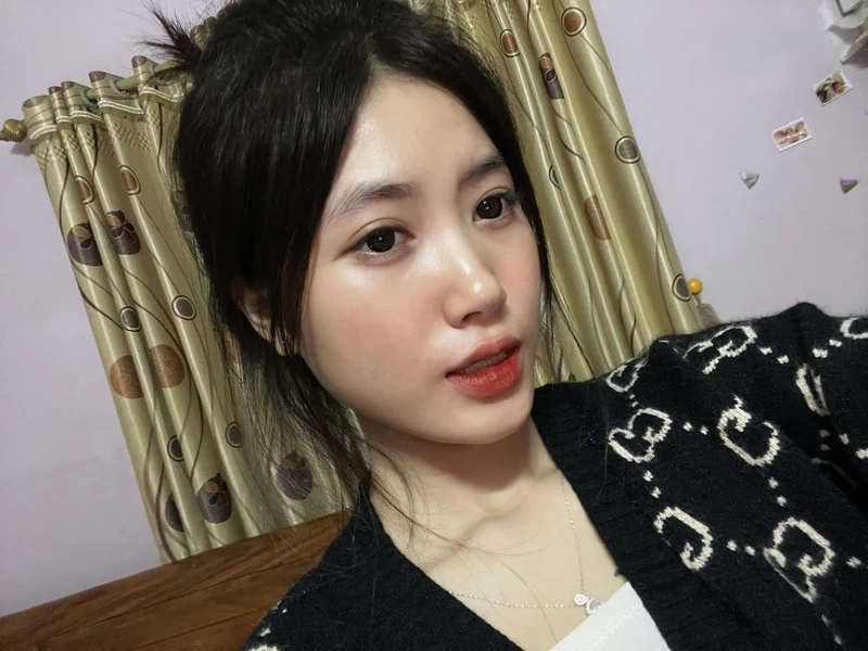 Story Instagram bị mờ có thể do ảnh gốc không đủ chất lượng