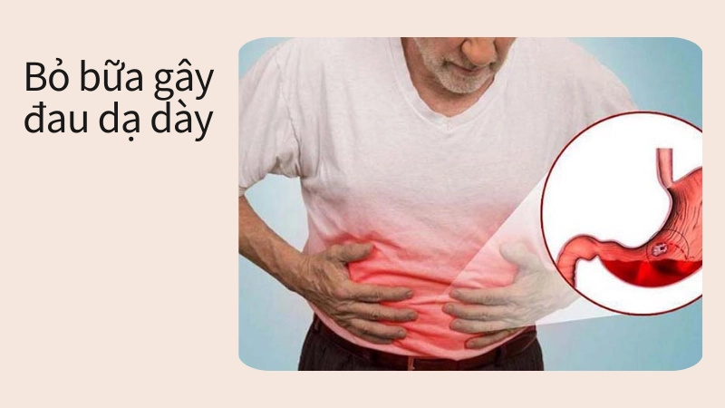 Hệ quả của việc bỏ bữa gây đau dạ dày cấp tính